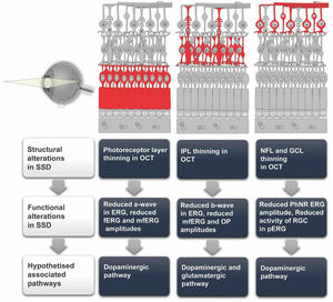 Structural and functional retinal alterations SSD and likely associated neurochemical trajectories. This figure illustrates specific retinal pathology observed in SSD and its functional manifestations. The top portion displays a cross-sectional diagram of the eye (left) and three distinct patterns of retinal layer abnormalities observed in SSD (highlighted in red): photoreceptor layer thinning, inner plexiform layer (IPL) thinning, and nerve fiber layer/ganglion cell layer (NFL/GCL) thinning. The flowchart demonstrates how these SSD-related structural alterations detected on optical coherence tomography (OCT) correspond to specific functional deficits measured by electroretinography (ERG). Photoreceptor damage in SSD correlates with reduced a-wave and altered full-field ERG (fERG) responses; IPL thinning associates with reduced b-wave, multifocal ERG (mfERG), and oscillatory potential (OP) abnormalities, while NFL/GCL thinning leads to reduced photopic negative response (PhNR) and pattern ERG (pERG) changes. The SSD-related retinal changes are hypothesised to primarily involve the dopaminergic pathway, with additional glutamatergic involvement in IPL pathology. This model suggests that retinal abnormalities may serve as accessible biomarkers reflecting central neurotransmitter disruptions characteristic of SSD. Of note, photoreceptor layer thinning depicted in this schematic is primarily supported by functional evidence (reduced a-wave amplitudes on ERG) rather than consistent structural findings on OCT, where photoreceptor-specific thinning in SSD remains less well established compared to RNFL and GCL changes.