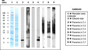SDS-PAGE immunoblotting del extracto de cascarilla de soja con los sueros de los pacientes con IgE específica positiva.