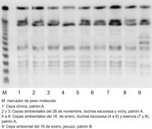 Patrones de electroforesis en las muestras de Legionela pneumophila ambientales y clínica.