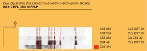 Dendrograma obtenido por RFLP de IS6110.