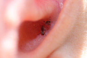 Dos ejemplares adultos de mosca negra picando en la oreja de uno de los técnicos, en los alrededores del pueblo de Ojós. (Fotografía tomada con cámara Canon EOS-700D y objetivo Canon EF-S 60/2,8 USM MACRO.)