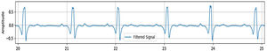 Subject 14 signal after filtered.