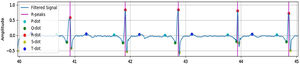 Results of QRS detection on subject 13.