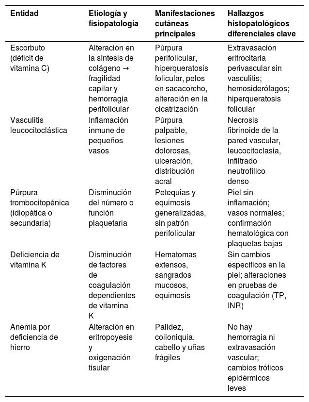 Tablas