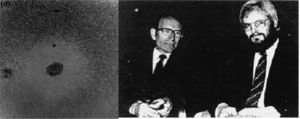 Microfotografía del primer hibridoma obtenido, reconocible por el halo de lisis producido por el anticuerpo monoclonal antihematíes. César Milstein y Georges Kohler el día que recibieron el Premio Nobel de Fisiología y/o Medicina en 1984.