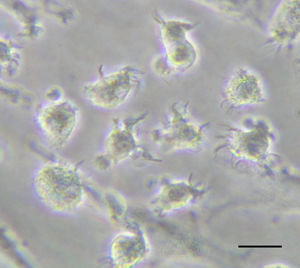 Human cytokine-matured monocyte-derived DC floating in culture media exhibiting prominent dendrites (Line: 20μm).