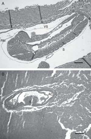 Microscopic appearance of embryos after the passive immunization in pregnant rats. Photomicrographs illustrating the developmental stage of embryos of 10 days: (a) nonspecific IgG control group – H/E, 200×. Scale bar=248μm, (b) anti-EPF IgG group – H/E, 100×. Scale bar=234μm. RM: Reichert's membrane, S: somites, EC: ecto-placental cavity, E: exo-coelom, AC: amniotic cavity, and VS: vitelline sac. Representative embryos are shown.