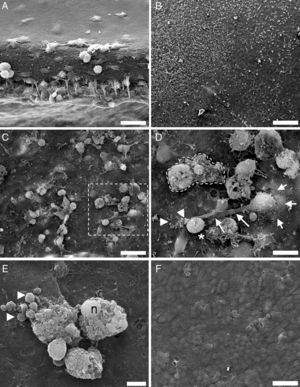 SEM analysis of control and infected brain organotypic cultures. (A) Shows the thickness of an organotypic culture, with the surface covered cells forming a flat surface. (B) Activation of microglia by L. monocytogenes shows numerous round cells which emerge from the tissue. (C) 5h after infection, bacteria and cell debris are actively hunted by microglial cells. (D) A microglial cell emerging through a protrusion (short arrows) in the tissue is trying to engulf free bacteria (arrowheads) and a big phagosome/cell filled with bacteria (asterisk), by means of a large cell pseudopodium (long arrows). The dotted line marks a necrotic cell with intact nuclei (n). (E) At 12h postinfection, numerous cell corpses with intact nuclei (n), cell debris, and phagosome-like particles of different size (arrowheads) are present at the surface of the tissues. (F) Surface of control tissue at 12h. Magnifications: (A, C, F) 2000×; (B) 500×; (D) 5000×; (E) 7585×. Scale bars: (A, D, F) 25μm; (B) 100μm; (C) 10μm; (E) 5μm.
