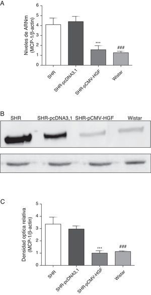 Expresión de MCP-1 en aorta de ratas SHR tratadas y no tratadas con HGF. Biopsias de ratas del grupo SHR-pCMV-HGF (n=6), del grupo SHR-pcDNA3.1 (n=6) y grupo control que fueron sacrificadas al final de la sexta semana. A. Se determinó la expresión de ARNm de MCP-1 en aorta por RT-qPCR. Los valores representan la media±la desviación estándar de las ratas evaluadas por grupo. Se evaluó cada muestra por triplicado, por rata. B. Representa la expresión de MCP-1 determinada por Western blot en SHR, SHR-pcDNA3.1, SHR-HGF and Wistar, n=6 en cada grupo. C. Representa la densidad óptica relativa de la expresión de MCP-1 en SHR, SHR-pcDNA3.1, SHR-HGF y Wistar, n=6 en cada grupo. ***p<0,01 comparación entre los grupos SHR-pCMV-HGF y SHR-pcDNA3.1. ###p<0,01 comparación entre los grupos SHR y Wistar.