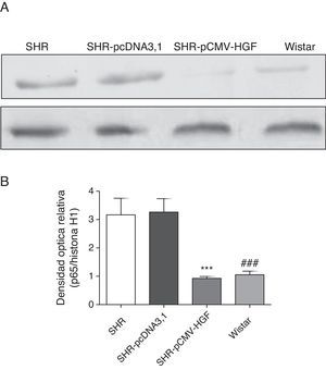 Expresión de la subunidad p65 del factor de transcripción NF-κB en aorta de ratas SHR tratadas y no tratadas con HGF. A. Biopsias de ratas del grupo SHR-pCMV-HGF (n=6), del grupo SHR-pcDNA3.1 (n=6) y grupo control que fueron sacrificadas al final de la sexta semana. Se determinó la expresión de la subunidad p65 del factor de transcripción NF-κB. Los valores representan la media+la desviación estándar de las ratas evaluadas por grupo. Se evaluó cada muestra por triplicado, por rata. B. Representa la densidad óptica relativa de la subunidad p65 del factor de transcripción NF-κB en los grupos estudiados. ***p<0,01 comparación entre los grupos SHR-pCMV-HGF y SHR-pcDNA3.1. ###p<0,01 comparación entre los grupos SHR y Wistar.