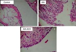 Imágenes histológicas de cortes sinoviales teñidos con hematoxilina-eosina, aumento 10x. a) Tejido de animales grupo control sin afectación sinovial. b) Grupo AAE con infiltración de linfocitos y células plasmáticas, hiperplasia y proliferación vascular. c) Grupo AAE + HCA, muestra disminución del infiltrado celular y menor neoangiogénesis respecto del AAE.