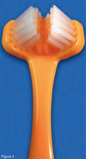 El cepillo de triple cabezal limpia simultáneamente las superficies lateral, masticatoria y externa.