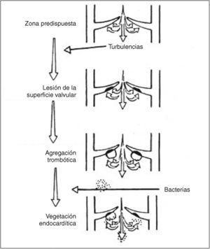 Proceso de formación de una vegetación endocardítica sobre una válvula patológica (modificado según Nager).