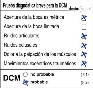 Resultado de la prueba diagnóstica breve de la DCM (disfunción craneomandibular): cinco de los seis criterios originalmente establecidos por Krogh-Poulsen fueron positivos en esta paciente.