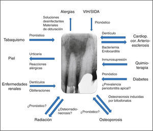 Interacciones entre el endodonto y la salud general.