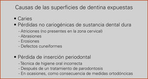 Posibles causas de las superficies de dentina expuestas.