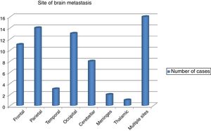 Distribution of brain metastasis within different brain regions.