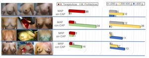 Técnicas de mastectomías y su relación con el peso de la mama. MAP: mastectomía ahorradora de piel; MAR: mastectomía reductora de piel; CAP: complejo aréola-pezón.