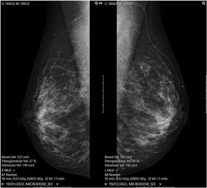 Mammographic measures obtained by the equipment.