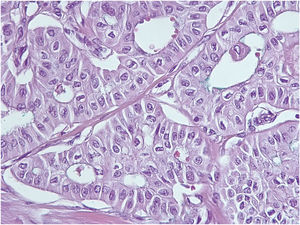 Células de citoplasma amplio eosinófilo con núcleos de polaridad invertida (en posición apical).