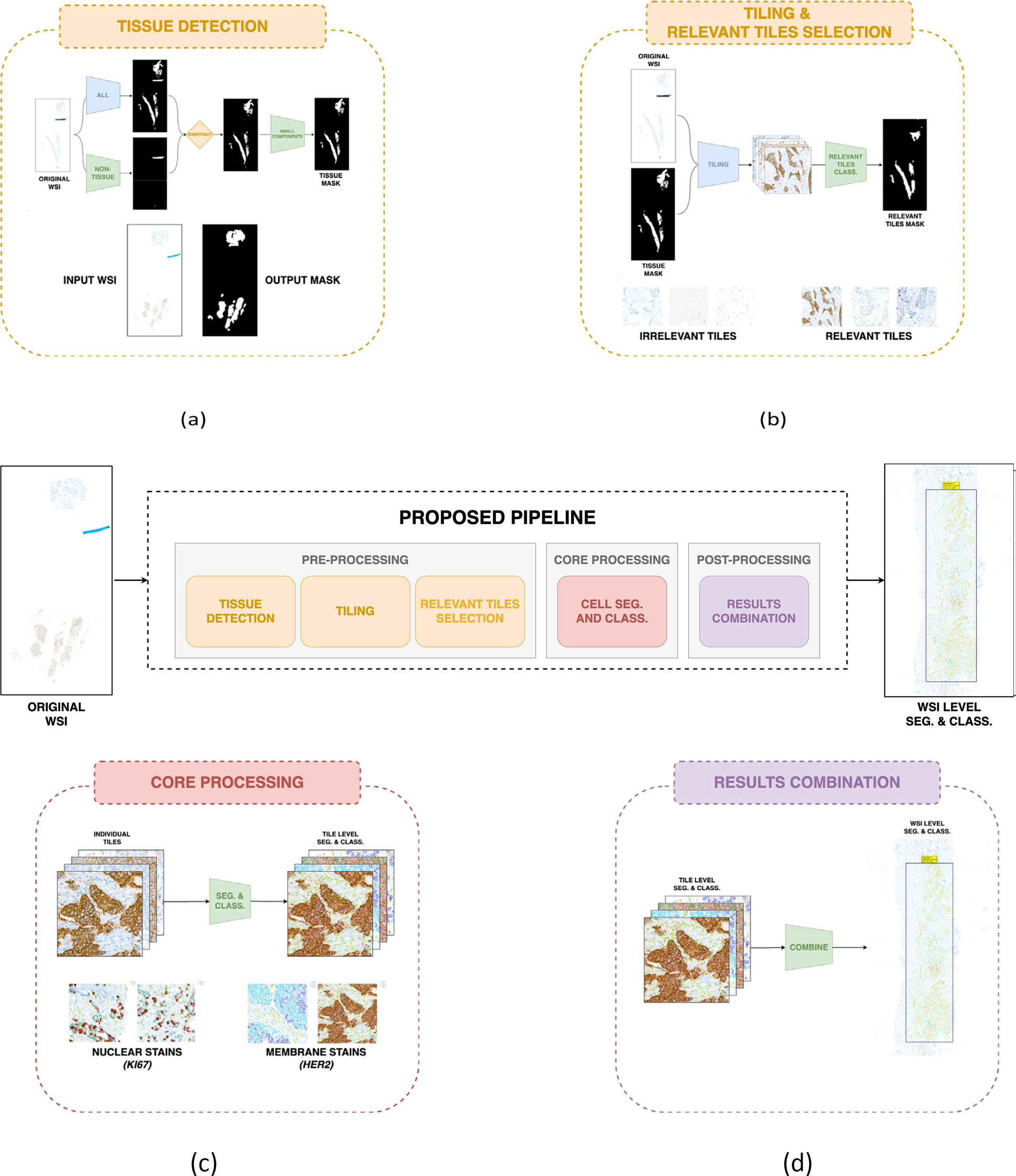Accelerating cancer diagnostics: A novel AI pipeline for efficient ...