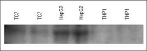 Valores de la apolipoproteína A-V determinados mediante Western blot en lisados totales de células intestinales TC-7, y también de células hepáticas HepG2 (utilizadas como control positivo) y de monocitos THP-1 (utilizados como control negativo), por duplicado.