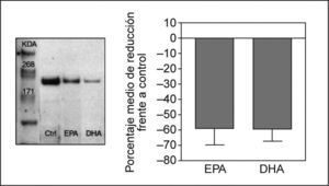 Expresión de la proteína NPC1L1 en extractos de proteína de membrana de enterocitos Caco-2/TC-7 incubadas durante 24h con EPA y DHA a concentración 200μM.