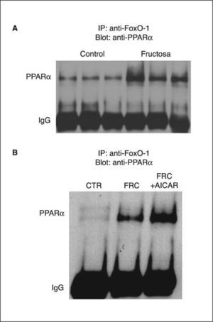 Coinmunoprecipitación del receptor alfa del activador-proliferador del peroxisoma (PPARα) y FoxO1 en muestras hepáticas de ratas suplementadas con fructosa (FRC). A. Extractos nucleares de 3 controles (CTR) y de 3 FRC que se sometieron a inmunoprecipitación con anticuerpo anti-FoxO1 asociado a partículas de proteína A agarosa. Los inmunoprecipitados se sometieron a SDS-PAGE y se inmunorrevelaron con anticuerpo anti-PPARα. Muestras del resto de animales utilizados en el estudio proporcionaron resultados similares. B. Extractos nucleares obtenidos por muestreo de cada muestra individual de ratas CTR, FRC y tratadas con 1 β-D ribofuranósido de 5-aminoimidazol 4-carboxamida (AICAR) (FRC + AICAR) se trataron tal como se describe en el apartado A.