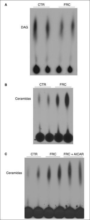 Valores de diacilglicerol (DAG) y ceramida en hígados de ratas suplementadas con fructosa (FRC). Se prepararon extractos lipídicos y se valoró la presencia de DAG y ceramida, como se detalla en el apartado Materiales y métodos. Se muestran fosfoimágenes del DAG (A) y la ceramida (B y C) presente en muestras hepáticas representativas, obtenidas por muestreo de 6 muestras individuales de ratas CTR, FRC y tratadas con 1 β-D ribofuranósido de 5-aminoimidazol 4-carboxamida (AICAR) (FCR + AICAR). CTR: control.