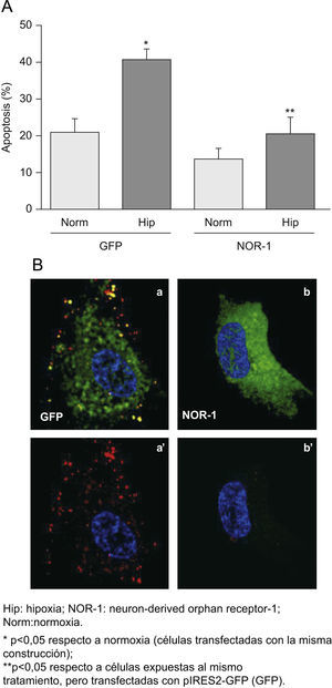 La sobreexpresión del neuron-derived orphan receptor (NOR-1) reduce la apoptosis de las células expuestas a hipoxia. Células endoteliales humanas de la vena del cordón umbilical que fueron transfectadas con pIRES2-GFP o con el plásmido recombinante que expresa GFP y NOR-1 (pGFP-NOR). A) Porcentaje de células apoptóticas determinada por fluorescence activated cell sorting en células GFP positivas transfectadas con pIRES2-GFP (GFP) o pGFP-NOR (GFP-NOR) y cultivadas en condiciones de normoxia o expuestas a hipoxia (1% de O2) durante 16h. B) Imágenes representativas de la microscopia confocal de células transfectadas con pIRES2-GFP (GFP; a, a’) o pGFP-NOR (NOR-1; b, b’) y expuestas a Hip. Las imágenes a’ y b’ muestran únicamente la unión de anexina v-R-PE (rojo).