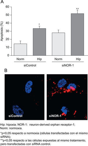 La inhibición Hip: hipoxia; NOR-1: neuron-derived orphan receptor-1; Norm: normoxia. de la expresión del neuron-derived orphan receptor-1 (NOR-1) incrementa la apoptosis de las células expuestas a hipoxia (Hip). A) Porcentaje de células apoptóticas en células transfectadas con el siControl o el siNOR-1 y cultivadas en condiciones de normoxia o expuestas a Hip (Hip, 1% de O2) durante 16h. B) Imágenes representativas de la microscopia confocal de las células transfectadas con siControl o siNOR-1 y expuestas a Hip.