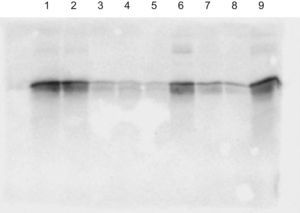 Western blot de la apo A-I Z. Carriles: 1. Post sonicación 2. Sobrenadante tras centrifugación 3. Sobrenadante no retenido por columna 4. Lavado 1 5. Lavado 2 6. Elución 1 7. Elución 2 8. Elución 3 9. Elución 1+Elución 2 dializado.
