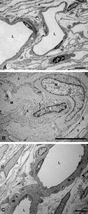Microscopía electrónica de las capas de los grandes vasos y vasos medianos. A) Animales control. B) En los conejos hipercolesterolémicos las luces vasculares están estrechadas, se observa la hipertrofia de las células musculares lisas y necrosis o hipertrofia de las células endoteliales. La membrana basal está engrosada. C) En los animales tratados con estatinas las luces vasculares, las musculares lisas, las endoteliales y la membrana basal eran más parecidas a las del grupo control que a la de los animales hipercolesterolémicos. (C: colágeno; E: célula endotelial; M: célula muscular lisa; mb: membrana basal; L: luz vascular; *: Lípido). (C: animal tratado con Fluvastatina sódica). Barra: 5μm.