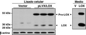 El sistema de expresión lentiviral incrementa en HUVEC el nivel de proteína LOX a nivel intra y extracelular. La sobreexpresión de LOX incrementó tanto el nivel de proenzima (pro-LOX; aprox 50 kDa) como el de LOX madura (LOX; 32 kDa), efecto evidente tanto en el análisis del extracto celular total como en el medio condicionado (Medio). Como control de carga se muestran los niveles de β-actina.