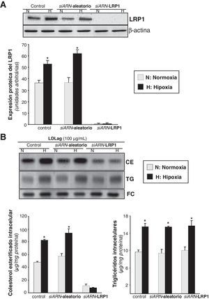 Efecto del la inhibición del LRP1 en la sobreacumulación de colesterol esterificado derivado de LDLag inducido por la hipoxia. Las CMLV se nucleofectaron con un siARN-LRP1 o un siARN-aleatorio (0,6μmol/l) como control. También se utilizaron como control células nucleofectadas en ausencia de siARN. Después de 48h de transfección, las CMLV se expusieron a normoxia (N) o hipoxia (H) y se recogieron al cabo de 24h para evaluar la expresión del LRP1. A) El Western blot y el diagrama de barras muestran la cuantificación de la expresión proteica del LRP1. Los niveles de α-actina se muestran como controles de carga. Los resultados están expresados como la media±SEM de 2 experimentos realizados por triplicado (*p<0,05 vs controles en normoxia). B) En los experimentos de carga lipídica, CMLV quiescentes se nucleofectaron con el siARN-LRP1 o el siARN-aleatorio (0,6μmol/l) y las células control se nucleofectaron en ausencia de siARN. Después de 48h de transfección, las CMLV se sometieron a normoxia o hipoxia durante 24h, de las cuales, las últimas 12h también se incubaron con LDLag (100μg/ml). Las células se recogieron para realizar una extracción lipídica, como se explica en la metodología. Los lípidos se separaron en una cromatografía en capa fina, se revelaron las bandas del contenido intracelular de colesterol esterificado (CE), triglicéridos (TG) y colesterol libre (FC); los histogramas muestran la cuantificación de las bandas de las CMLV sometidas a normoxia o hipoxia. Los resultados están expresados como microgramos de colesterol por miligramo de proteína y se muestra la media±SEM de 3 experimentos realizados por triplicado (* p<0,05 vs controles en normoxia).
