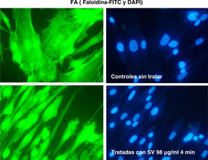 Tinción de las estructuras de actina en fibroblasto. Modificaciones inducidas por la simvastatina (98 μg/ml).