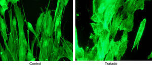 Tinción de actina en fibroblastos y efecto del tratamiento con estatina.