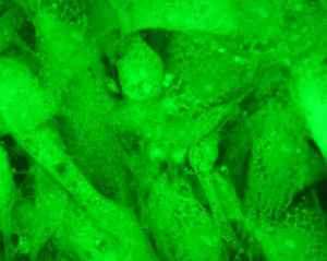 Inmunofluorescencia con anticuerpos monoclonales frente a actina en células musculares lisas sin tratamiento.