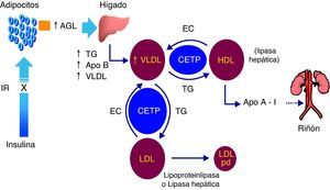 Mecanismos de producción de la dislipidemia diabética. AGL: ácidos grasos libres; Apo: apolipoproteína; CETP: proteína transferidora de ésteres de colesterol; EC: ésteres de colesterol; HDL: lipoproteínas de alta densidad; IR: insulinorresistencia; LDL: lipoproteínas de baja densidad; pd: pequeñas y densas; TG: triglicéridos; VLDL: lipoproteínas de muy baja densidad.