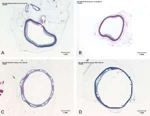 Aortic sections of each one of the treated groups. Panel A: control group; Panel B: atorvastatin group; Panel C: PES group; and Panel D: PES and atorvastatin group. Staining using the elastic trichrome method. 2×.