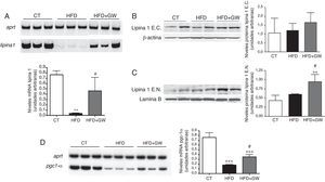 El tratamiento con GW501516 aumenta los niveles de lipina1 nuclear en el hígado de ratones alimentados con la HFD. A) Niveles de ARNm de lipina1. Autorradiografía representativa y cuantificación normalizada respecto a los niveles de ARNm del gen control Aprt. Los resultados se expresan como la media±DE (n=5). Niveles proteicos de lipina1 citosólica (B) y nuclear (C) en el hígado. Como control de carga se utilizó β-actina (extractos citosólicos) y laminaB (extractos nucleares). D) Niveles de ARNm de Pgc-1α. *p<0,05; **p<0,01; ***p<0,001 vs ratones control; #p<0,05; ##p<0,01 vs ratones alimentados con la HFD.