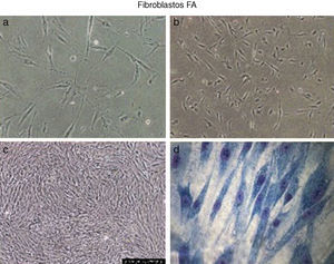 Cultivo de fibroblastos.