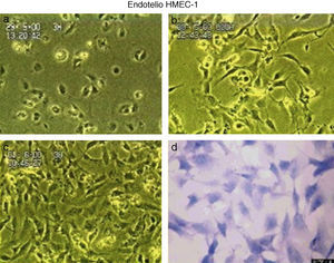 Cultivo de células endoteliales (HMEC-1).