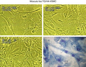 Cultivo de células musculares lisas (TG/HA-VSMC).