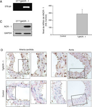 Caracterización de la expresión de NOR-1 en la pared vascular de los ratones transgénicos (TgNOR-1+CML). A)Tinción con bromuro de etidio del gel de agarosa en la que se muestra el fragmento de NOR-1 amplificado por PCR (579pb) a partir de ADN genómico de ratones transgénicos (TgNOR-1). El amplicón no se detecta en ADN genómico de animales normales (Control, CT). B)Nivel de ARNm de NOR-1 humano analizado por PCR a tiempo real en la aorta de los animales transgénicos. En los ratones control no se detectó la expresión de NOR-1 humano, pero se le atribuyó un valor de 1 con fines comparativos. Los datos se expresan como la media±SEM de al menos 9animales. *p<0,001 vs. control. C)Niveles de proteína de NOR-1 determinados por Western-blot en la aorta de estos animales. Los niveles de GAPDH se muestran como control de carga. D)Análisis inmunohistoquímico de NOR-1 realizado en las arterias carótida (izquierda) y aorta (derecha) procedente de ratones transgénicos (superior) y control (inferior).