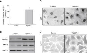 NOR-1 se sobreexpresa en CMLV de aorta de ratones TgNOR-1+CML. A)Niveles de ARNm de NOR-1 humano (hNOR-1) analizado por PCR a tiempo real en CMLV de aorta de los ratones transgénicos (TgNOR-1). La expresión de NOR-1 humano fue indetectable en las células de los ratones control, pero se asignó valor arbitrario de 1 con fines comparativos. Los datos se expresan como la media±DE (n=6). *p<0,001 vs. CT. B)Nivel de expresión de NOR-1 y del marcador Myh10 analizados por Western-blot en extractos nucleares y en lisado celular, respectivamente, de CMLV de animales control y transgénicos. Los niveles de GAPDH se muestran como control de carga. C,D)Caracterización mediante inmunocitoquímica de la expresión de NOR-1 (C) y Myh10 (D) en estas células de animales control y transgénicos.