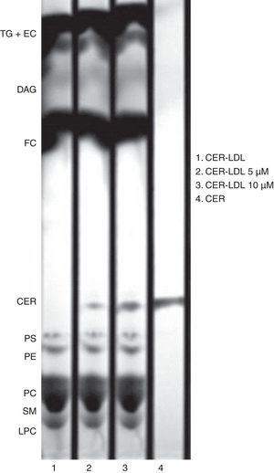 Representative TLC of lipid extracts of CER-LDL 0, 5 and 10μM. CER-LDL 0μM was LDL processed in parallel but with no addition of CER. The CER used as compound was added to the TLC silica gel plate as standard. TG: triglycerides, EC: esterified cholesterol, DAG: diacylglycerol, FC: free cholesterol, CER: ceramide, PS: phosphatidylserine, PE: phosphatidylethanolamine, PC: phosphatidylcholine, SM: sphigomyelin, LPC: lisophosphatidylcholine.
