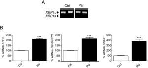 El palmitato induce el estrés del RE en cardiomiocitos AC16. A) Niveles de XBP1u/XBP1s (unspliced/spliced) determinados mediante RT-PCR y B) cuantificación relativa de los niveles de ARNm de ATF3, CHOP y BiP/GRP78 determinados mediante RT-PCR cuantitativa en tiempo real, de muestras obtenidas de células AC16 tratadas con palmitato (Pal, 0,25mM, 18h). Los gráficos representan los niveles de ARNm normalizados con el gen control 18S y están expresados como porcentaje respecto el grupo control (Ctrl)±DE. ***p<0,001 vs. Ctrl.
