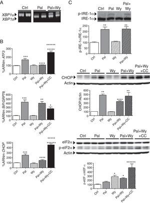 Efecto de la activación de PPARα con Wy-14,643 sobre el estrés del RE. Células AC16 fueron tratadas con palmitato (Pal, 0,25mM, 18h) en presencia o ausencia de Wy-14,643 (Wy, 10μM, 24h) y del Compuesto C (CC, 30μM, 25h). A) Niveles de XBP1u/XBP1s (unspliced/spliced) determinados mediante RT-PCR. B) Cuantificación relativa de los niveles de ARNm de ATF3, CHOP y BiP/GRP78 determinados mediante RT-PCR cuantitativa en tiempo real. Los gráficos representan los niveles de ARNm normalizados con el gen control 18S y están expresados como porcentaje respecto del grupo control (Ctrl)±DE. C) Análisis por Western-blot de los niveles de proteína IRE-1α total y fosforilada, CHOP, y eIF2α total y fosforilada en Ser51. Los gráficos representan la cuantificación de los niveles de proteína normalizados y están expresados como porcentaje de las muestras control±DE. Todas las autorradiografías son representativas de 2 experimentos independientes. *p<0,05 vs. Ctrl. **p<0,01 vs. Ctrl. ***p<0,001 vs. Ctrl. ****p<0,05 vs. Pal. *****p<0,01 vs. Pal. ******p<0,01 vs. Pal+Wy.