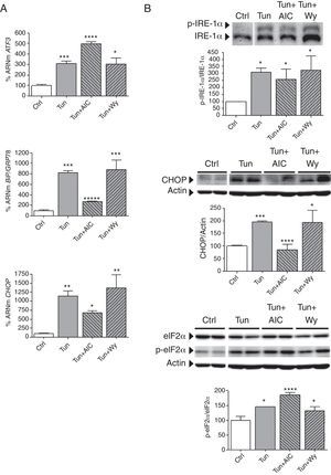 AICAR, pero no Wy-14,643, previene el estrés del RE inducido por tunicamicina. Células AC16 fueron tratadas durante 4h con tunicamicina (Tun, 5μg/ml) en presencia o ausencia de AICAR (AIC, 2mM, 24h) o Wy-14,643 (Wy, 10μM, 24h). A) Cuantificación relativa de los niveles de ARNm de ATF3, CHOP y BiP/GRP78 determinados mediante RT-PCR cuantitativa en tiempo real. Los gráficos representan los niveles de ARNm normalizados con el gen control 18S y están expresados como porcentaje respecto del grupo control (Ctrl)±DE. B) Análisis por Western-blot de los niveles de proteína IRE-1α total y fosforilada, CHOP, y eIF2α total y fosforilada en Ser51. Los gráficos representan la cuantificación de los niveles de proteína normalizados y están expresados como porcentaje de las muestras control±DE. Todas las autorradiografías son representativas de 2 experimentos independientes. *p<0,05 vs. Ctrl. **p<0,01 vs. Ctrl. ***p<0,001 vs. Ctrl. ****p<0,05 vs. Tun. *****p<0,01 vs. Tun.